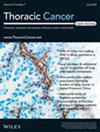 Thoracic Cancer